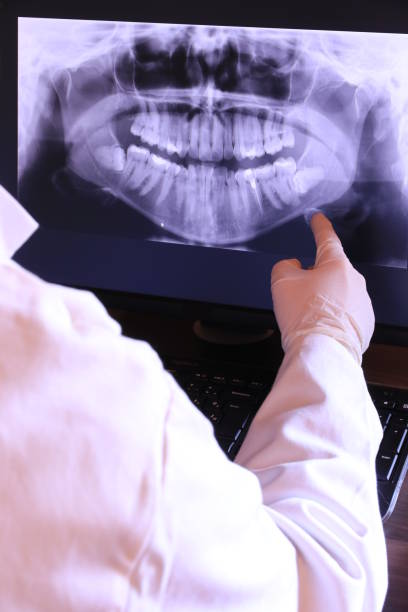 Best Knocked-Out Tooth Emergency  in Torrance, CA