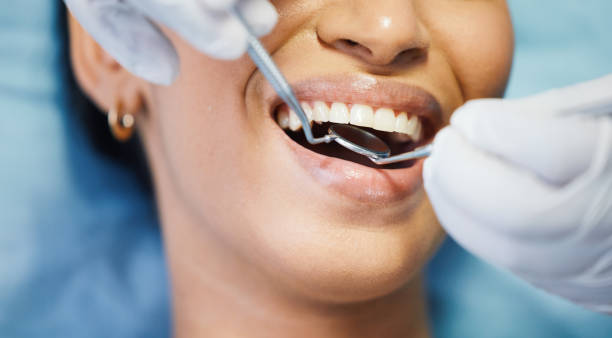 Best Emergency Dental Filling Replacement  in Torrance, CA