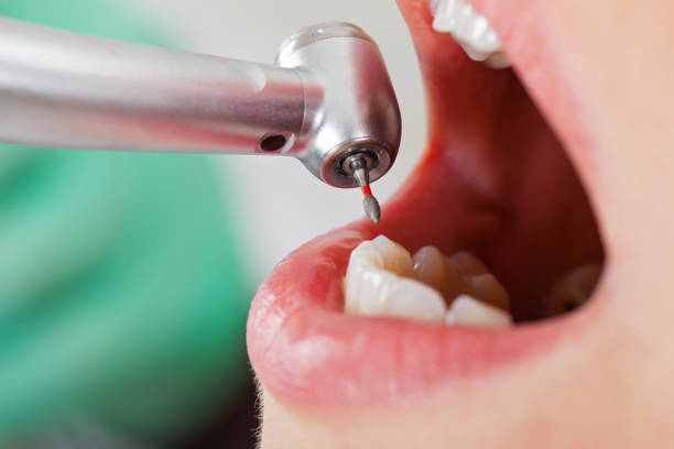 Best Dentist for Dental Trauma  in Torrance, CA
